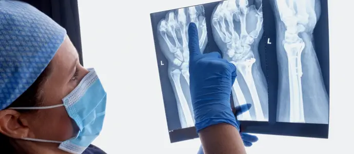 Doctor examines an x-ray of a hand and wrist